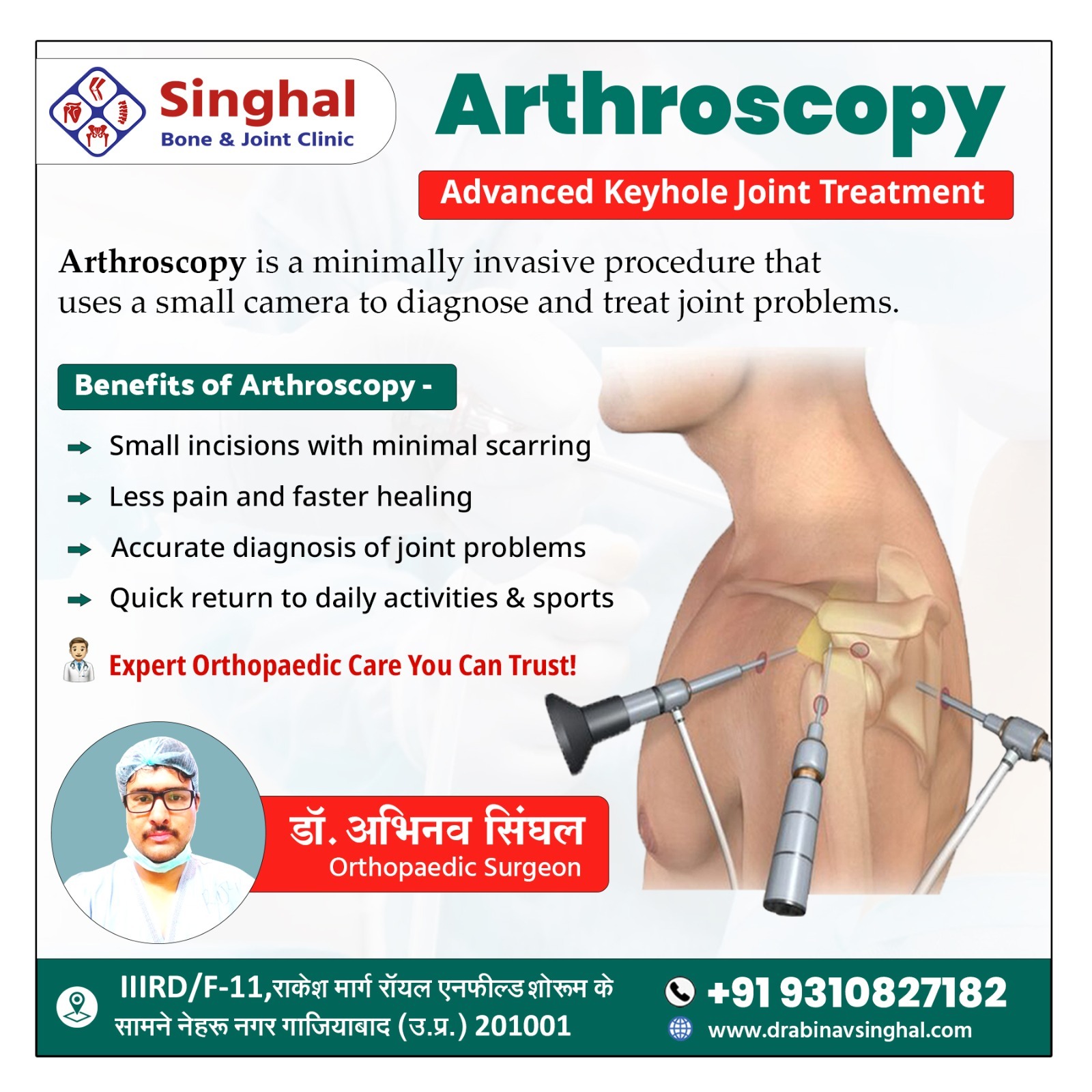 Arthroscopy in Ghaziabad showing minimally invasive keyhole joint surgery for shoulder treatment by Dr. Abhinav Singhal