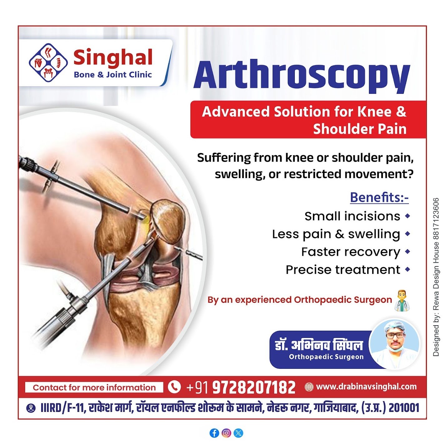 Arthroscopy treatment for knee and shoulder pain in Ghaziabad by Dr. Abhinav Singhal